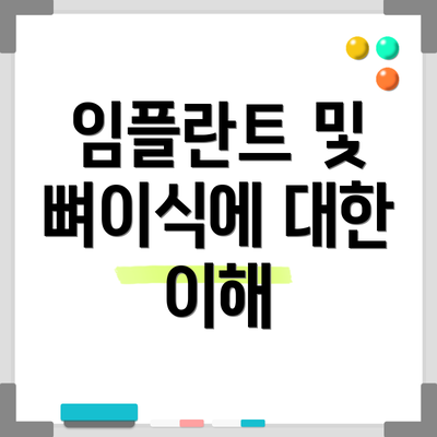 임플란트 및 뼈이식에 대한 이해